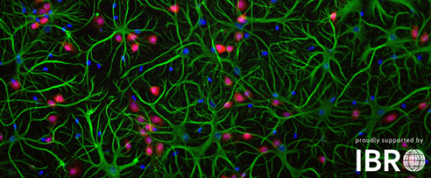 Astrocytes in green